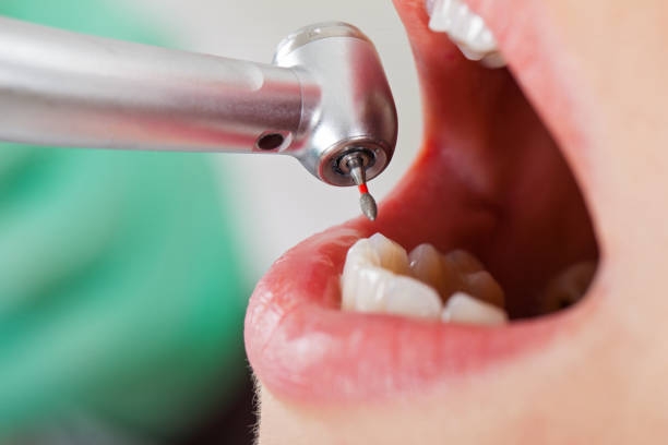 Best Emergency Tooth Extraction  in Baywood Park, CA